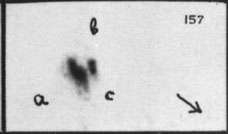 VV157